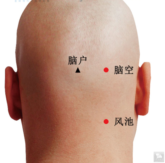 取穴:太阳穴 风池穴七,操作方法活血止痛,疏通经络   病位在头部,当