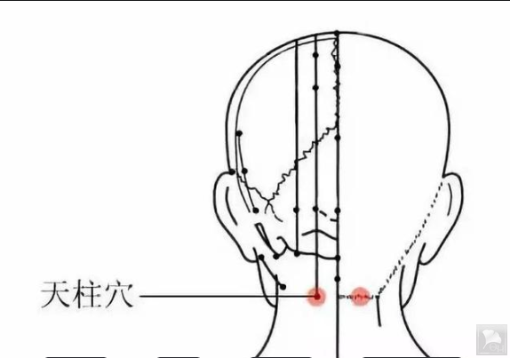 岐黄针疗法治疗落枕病例分享
